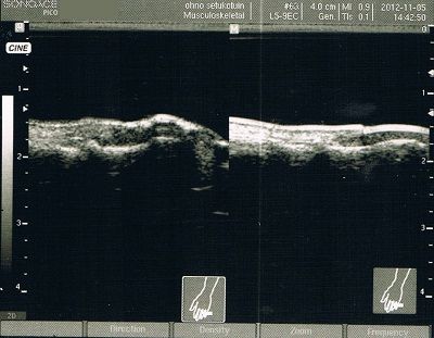 超音波画像2